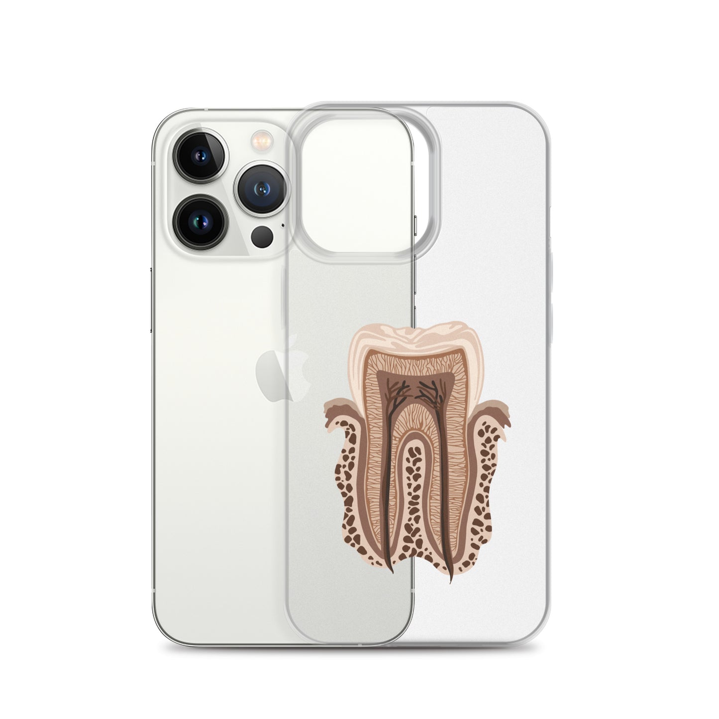 Clear Case for iPhone®