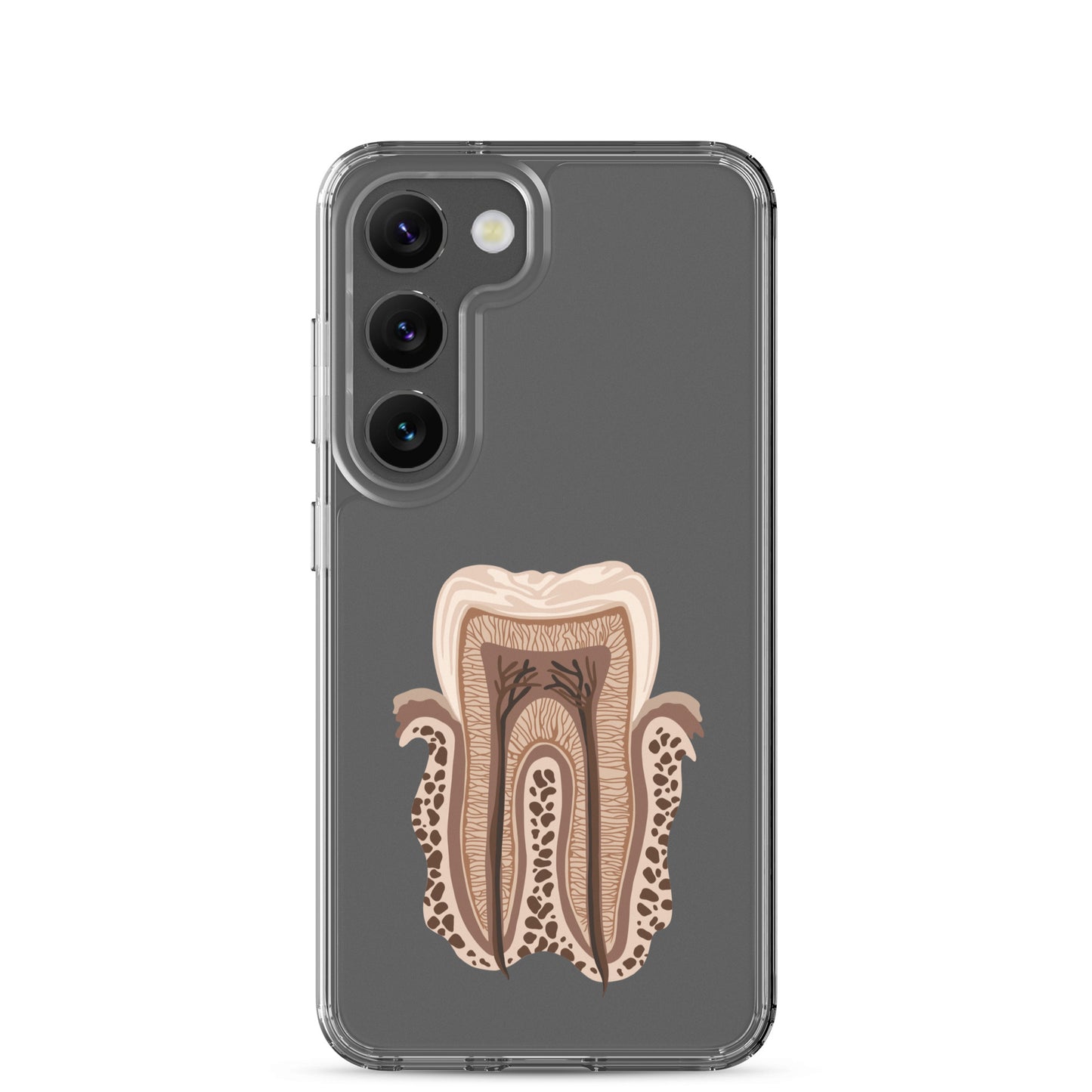 Clear Case for Samsung®