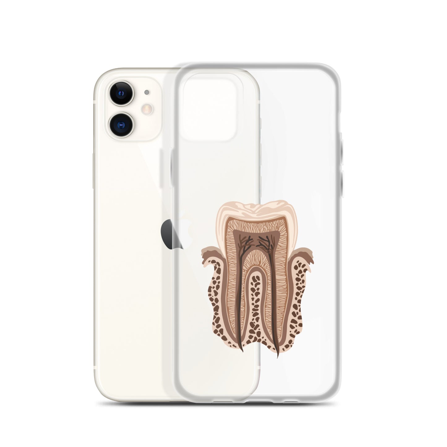 Clear Case for iPhone®