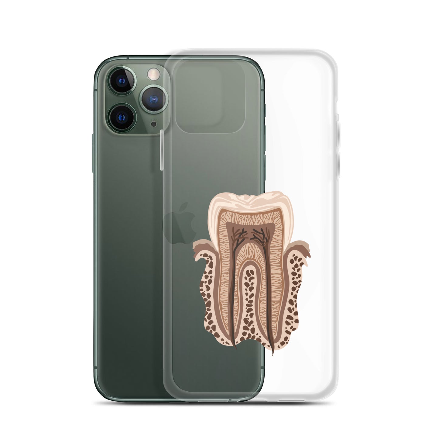 Clear Case for iPhone®