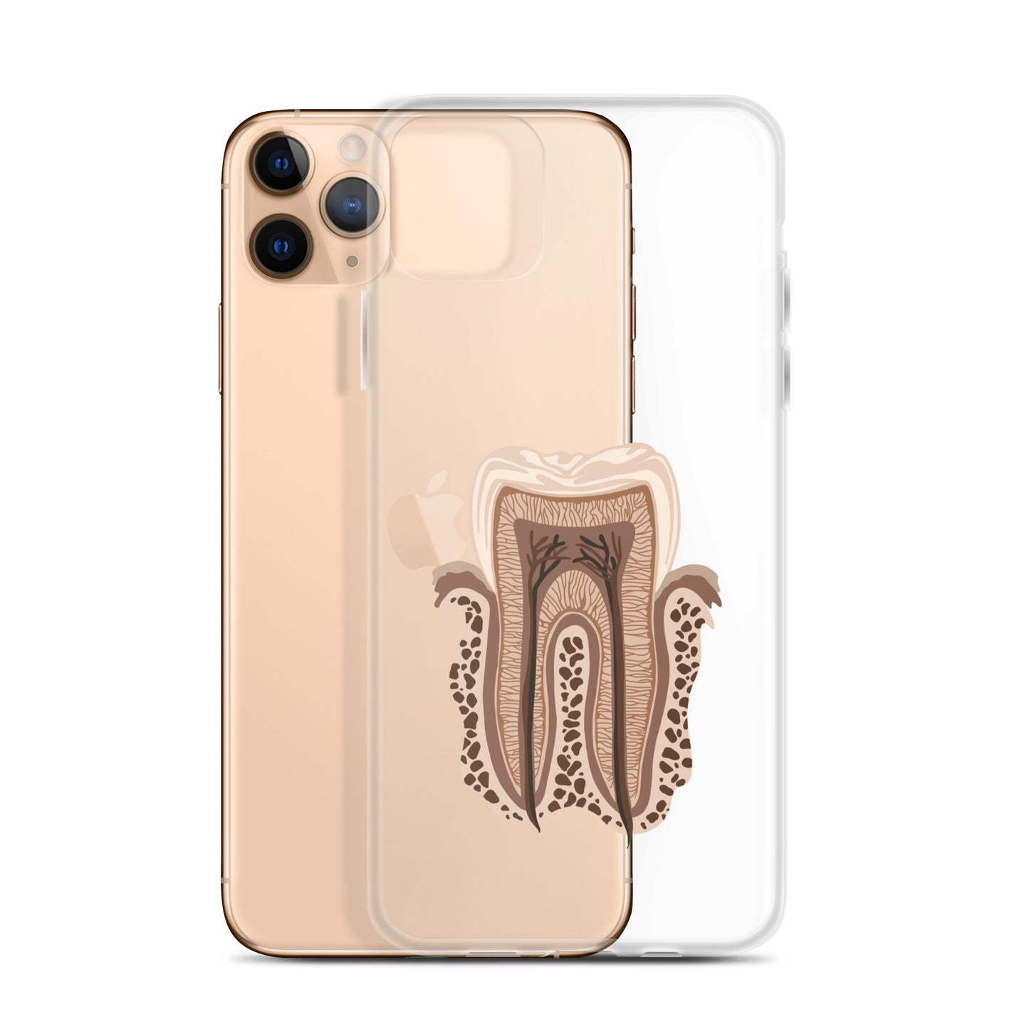 Clear Case for iPhone®