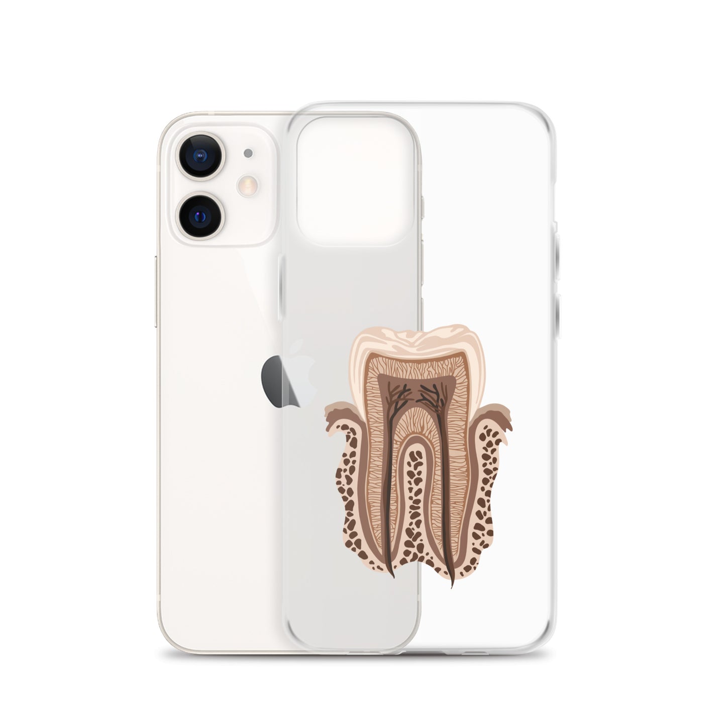 Clear Case for iPhone®