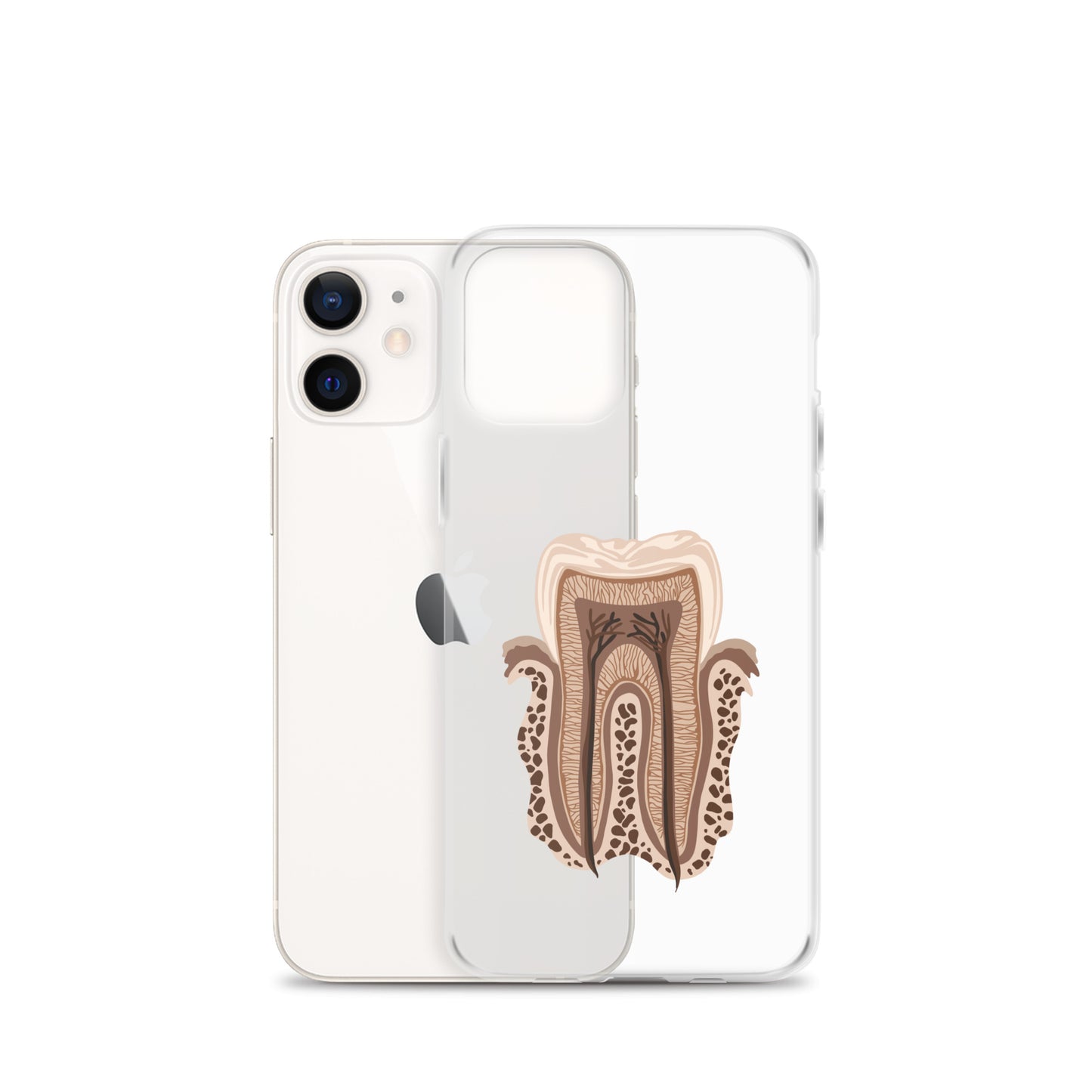 Clear Case for iPhone®