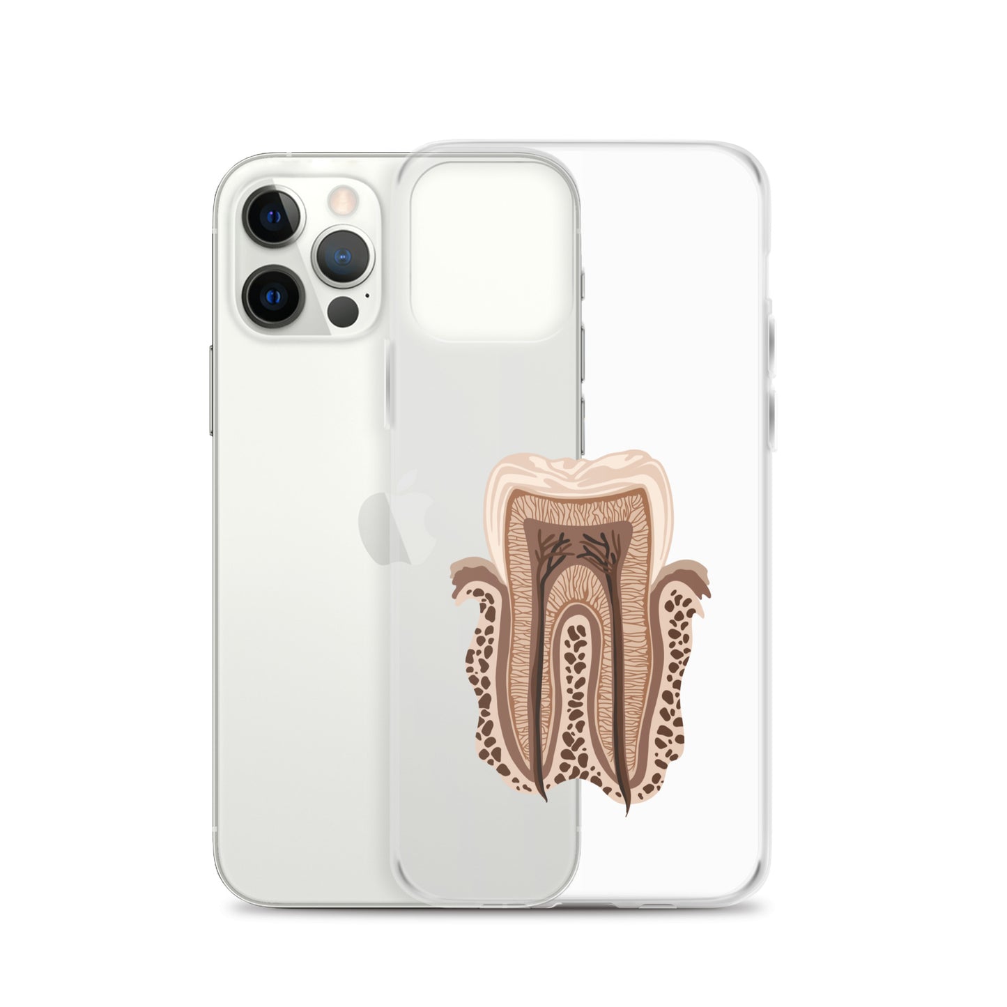 Clear Case for iPhone®