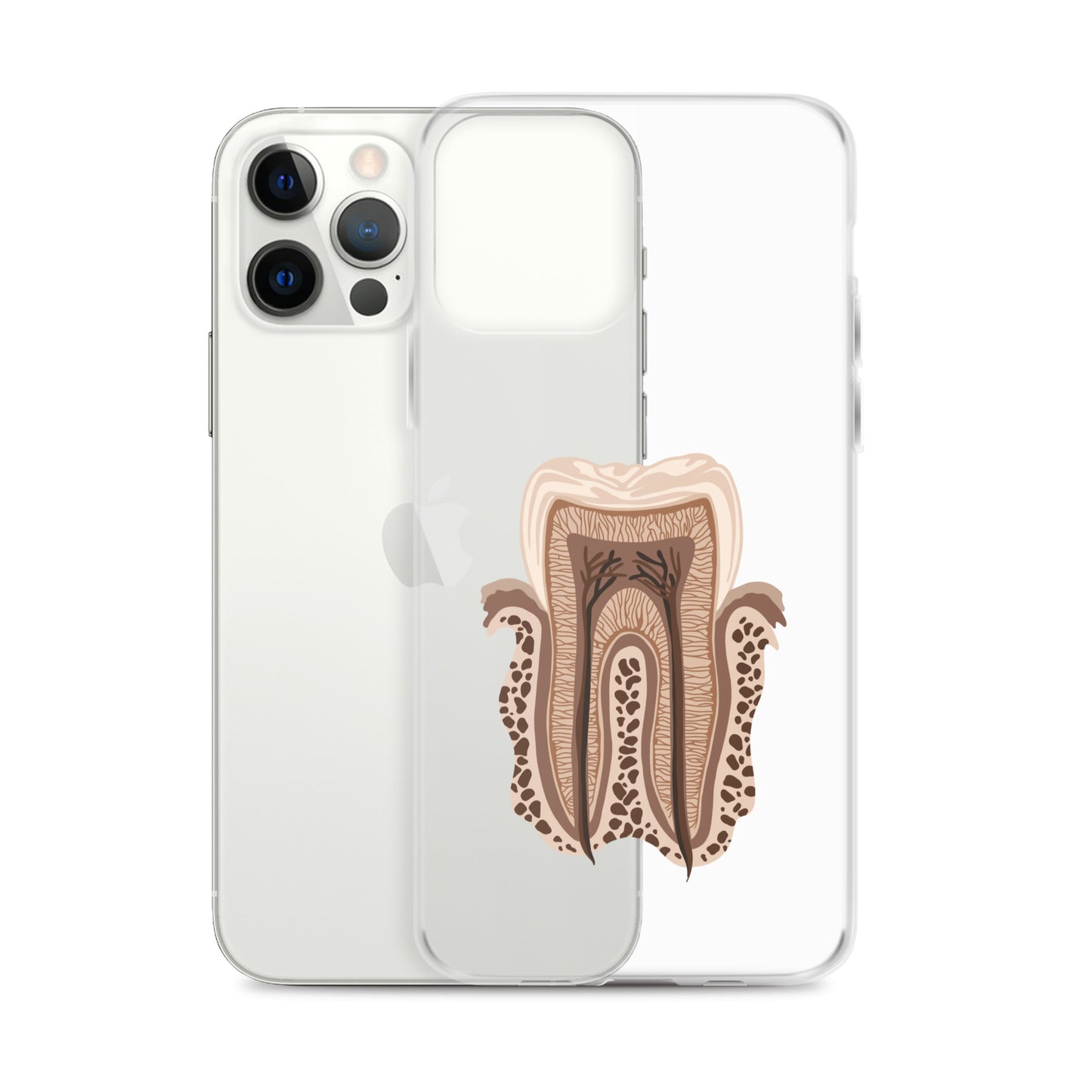 Clear Case for iPhone®