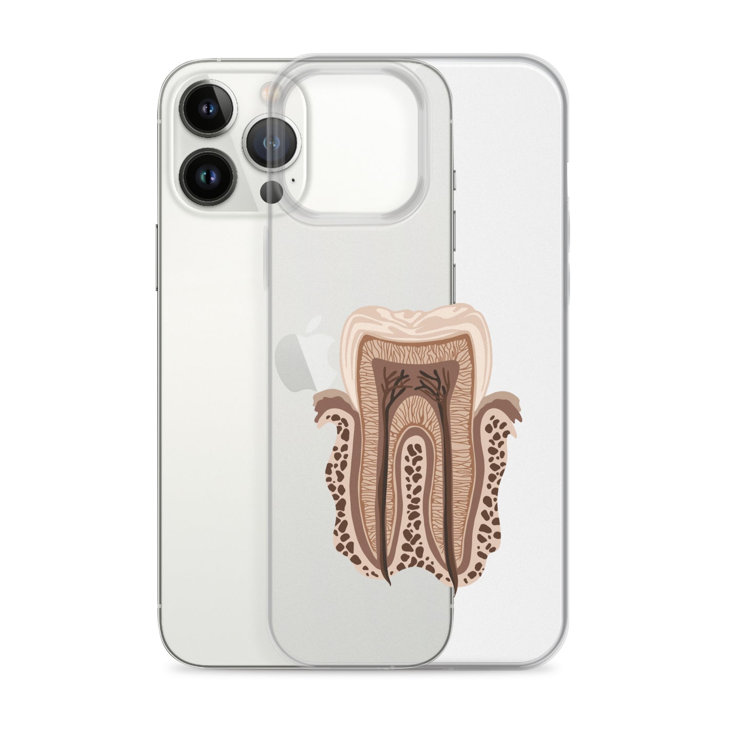 Clear Case for iPhone®