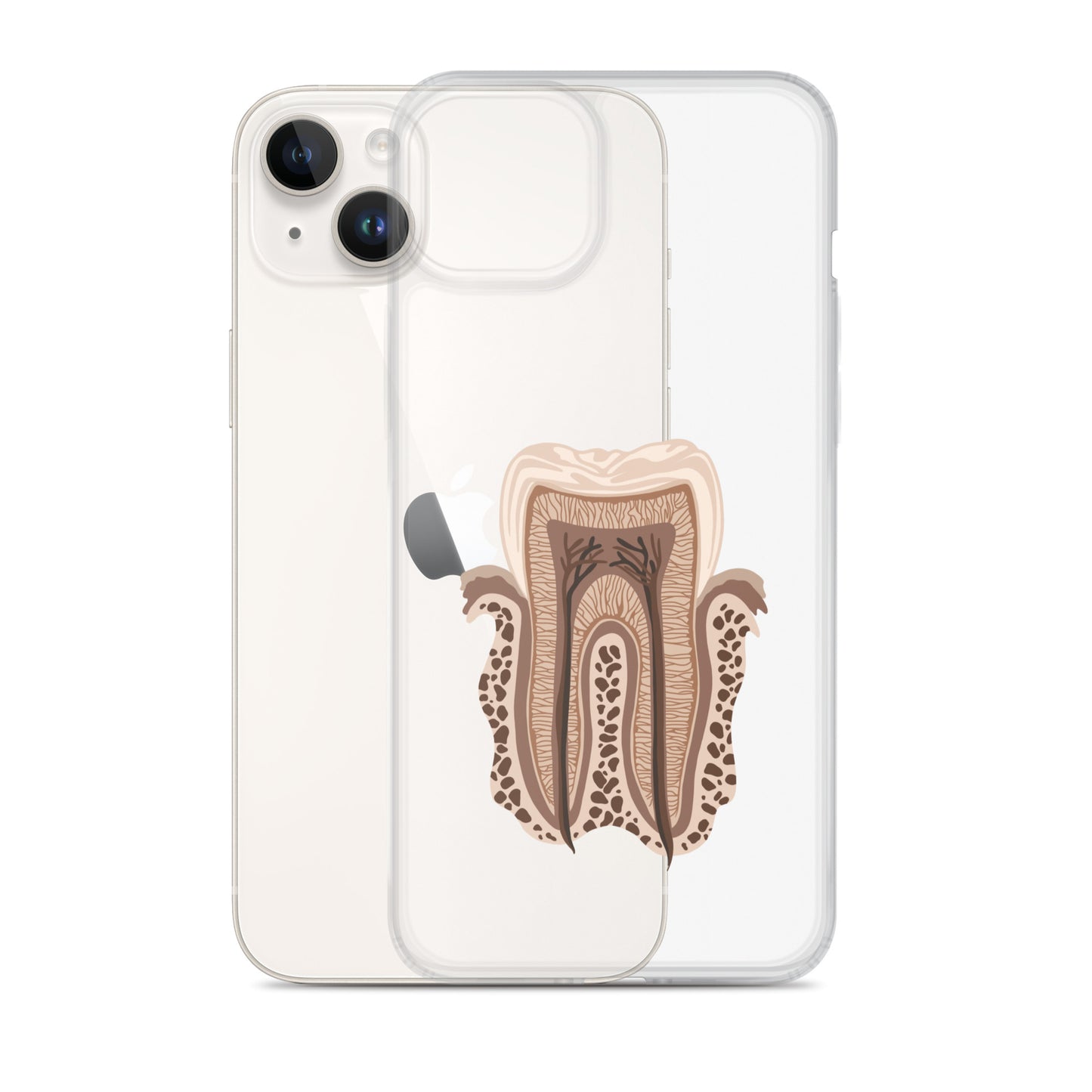 Clear Case for iPhone®