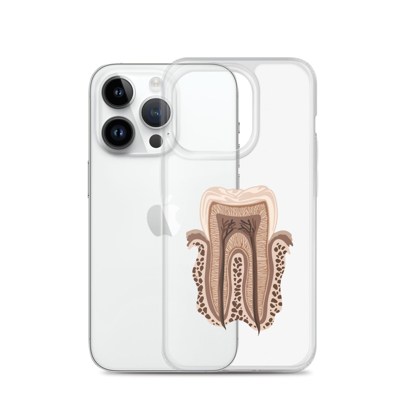 Clear Case for iPhone®