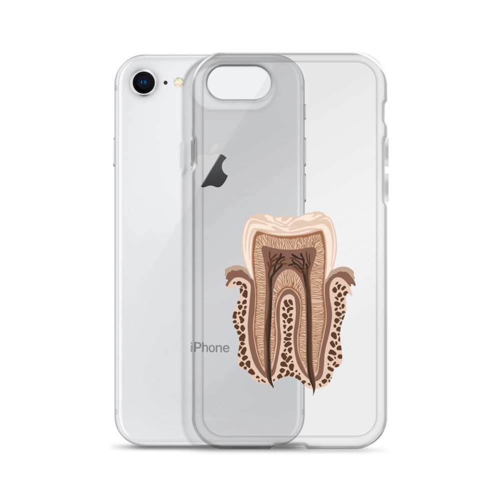 Clear Case for iPhone®