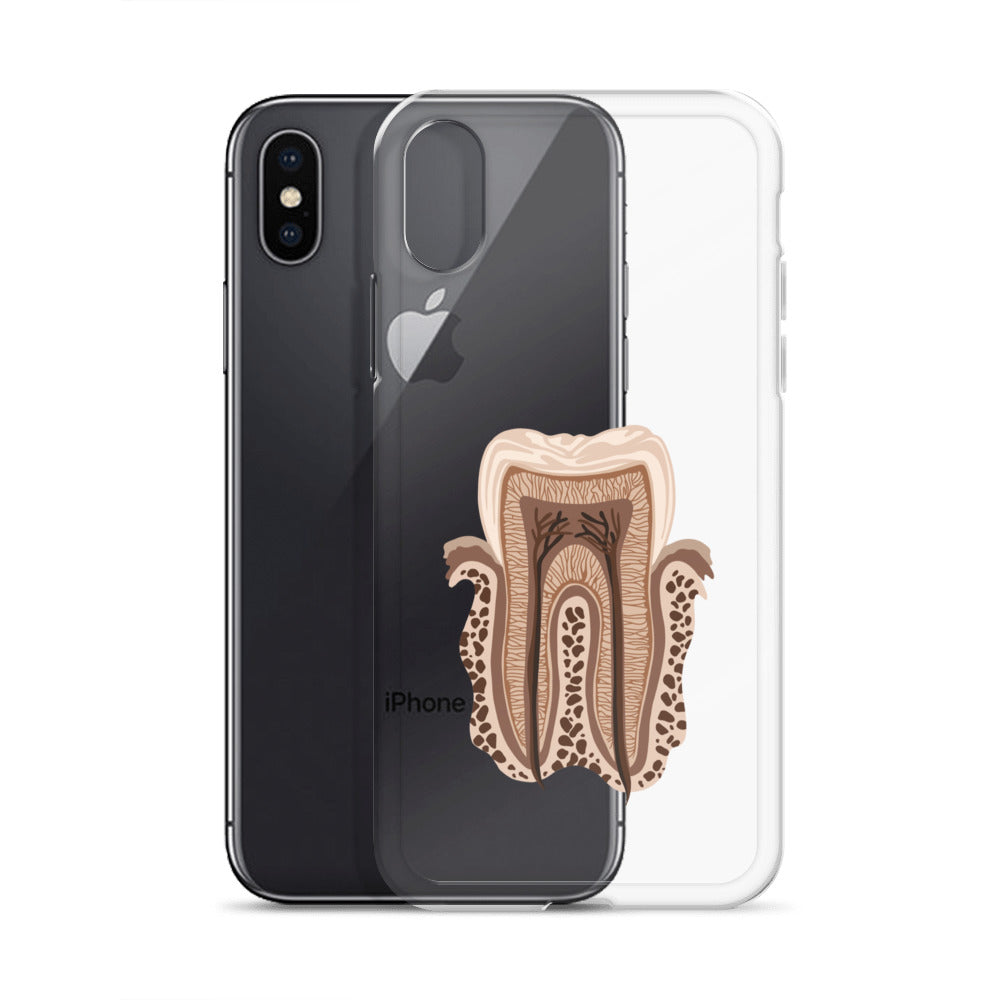 Clear Case for iPhone®