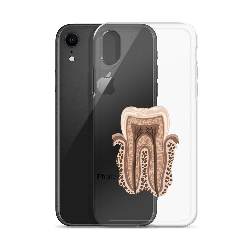 Clear Case for iPhone®