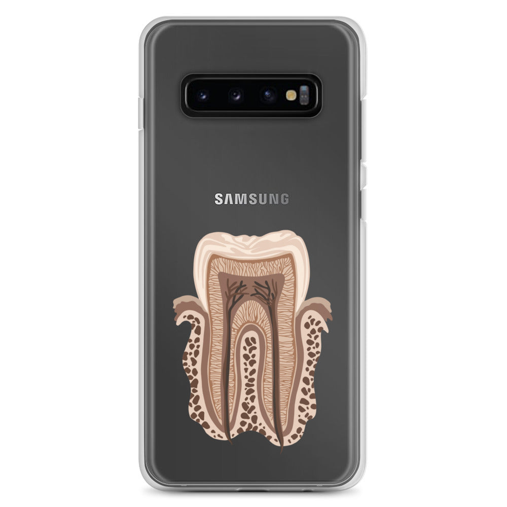 Clear Case for Samsung®