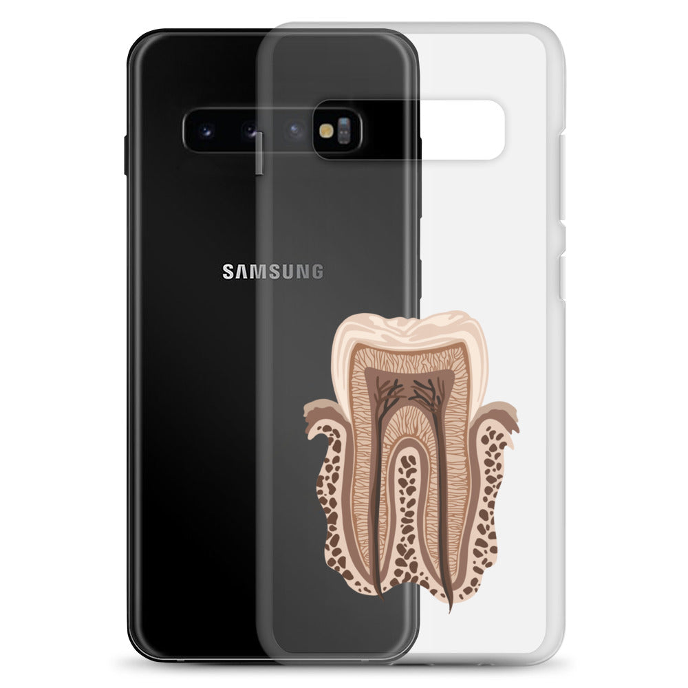 Clear Case for Samsung®