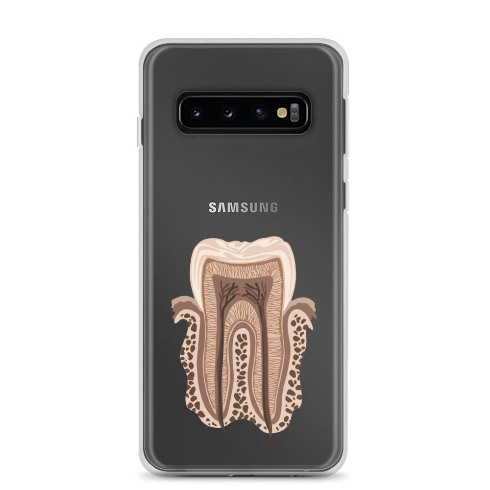 Clear Case for Samsung®