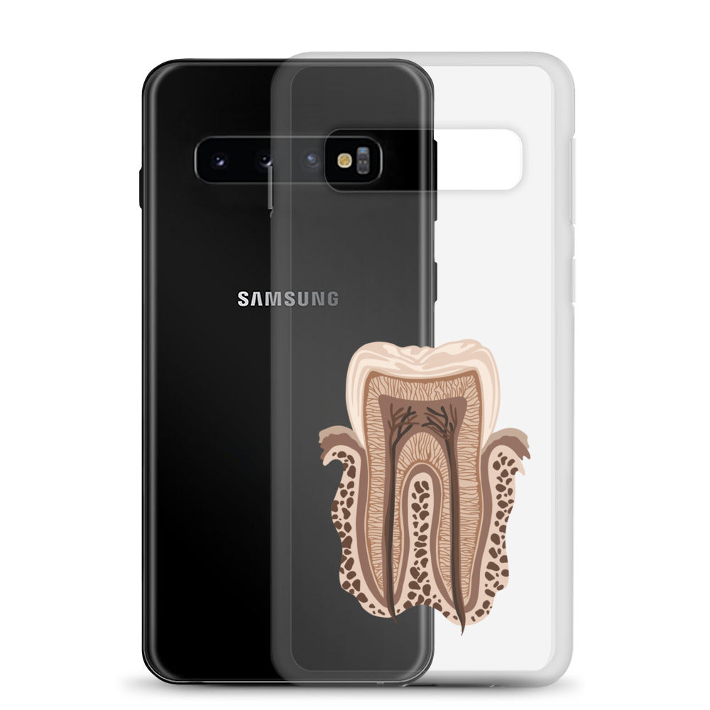 Clear Case for Samsung®