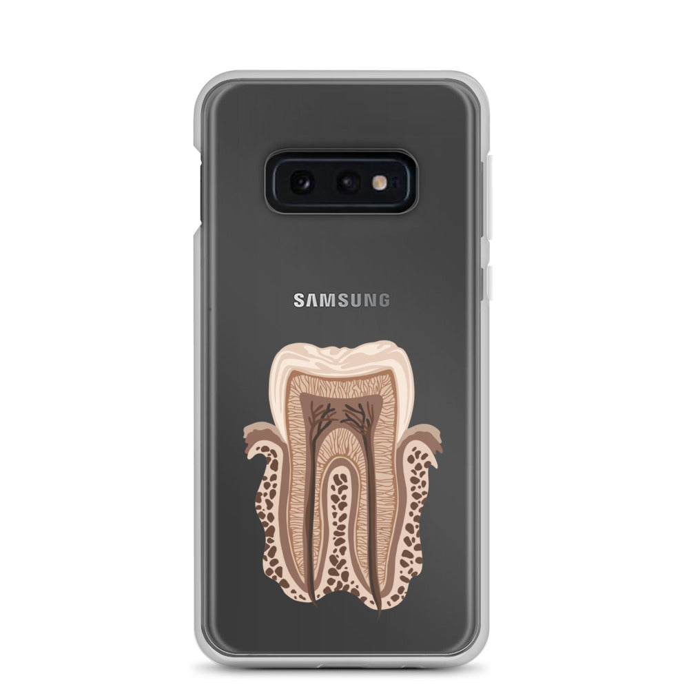 Clear Case for Samsung®