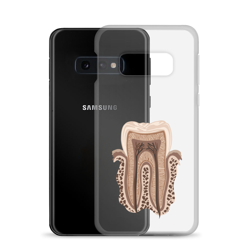 Clear Case for Samsung®